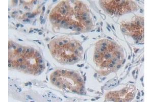 Immunohistochemistry (IHC) image for anti-Selectin P (Granule Membrane Protein 140kDa, Antigen CD62) (SELP) (AA 198-432) antibody (ABIN7441859)