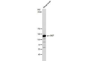 Western Blotting (WB) image for anti-O-Linked N-Acetylglucosamine (GlcNAc) Transferase (UDP-N-Acetylglucosamine:polypeptide-N-Acetylglucosaminyl Transferase) (OGT) antibody (ABIN2856718)