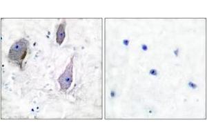 Immunohistochemistry analysis of paraffin-embedded human brain tissue, using PMP22 Antibody. (PMP22 Antikörper  (AA 111-160))