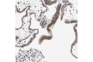 Immunohistochemical staining of human placenta with TMF1 polyclonal antibody  shows strong cytoplasmic positivity with granular pattern in trophoblastic cells at 1:200-1:500 dilution. (TMF1 Antikörper)