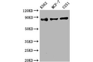 Western Blot Positive WB detected in: K562 whole cell lysate, MCF-7 whole cell lysate, U251 whole cell lysate All lanes: IKK beta antibody at 1:2000 Secondary Goat polyclonal to rabbit IgG at 1/50000 dilution Predicted band size: 87 kDa Observed band size: 87 kDa (Rekombinanter IKBKB Antikörper)