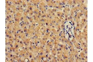 Immunohistochemistry of paraffin-embedded human liver tissue using ABIN7154093 at dilution of 1:100 (GSTA4 Antikörper  (AA 1-222))