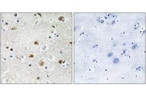 Immunohistochemistry analysis of paraffin-embedded human brain tissue, using TF3B Antibody. (BRF1 Antikörper  (AA 231-280))