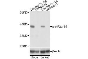 Western blot analysis of extracts of HeLa and Jurkat cells,using Phospho-eIF2α-S51 antibody. (EIF2S1 Antikörper  (pSer51))