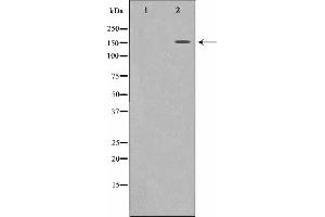 Western blot analysis on 293 cell lysate using MRC2 Antibody,The lane on the left is treated with the antigen-specific peptide. (MRC2 Antikörper  (N-Term))