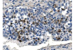 IHC analysis of TMPRSS3 using anti-TMPRSS3 antibody (ABIN7601198). (TMPRSS3 Antikörper  (AA 3-454))
