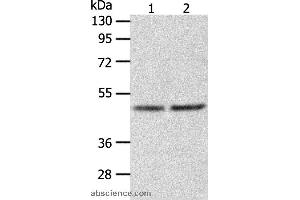 Western blot analysis of Human fetal liver tissue and hepg2 cell, using AGXT Polyclonal Antibody at dilution of 1:1050 (AGXT Antikörper)