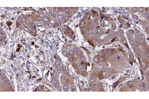 Immunohistochemistry (IHC) image for anti-Potassium Voltage-Gated Channel, Isk-Related Family, Member 1 (KCNE1) (Internal Region) antibody (ABIN6262741)
