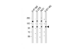 All lanes : Anti-THSD1 Antibody (C-Term) at 1:2000 dilution Lane 1: U-87 MG whole cell lysate Lane 2: U-2OS whole cell lysate Lane 3: A431 whole cell lysate Lane 4: U-251 MG whole cell lysate Lysates/proteins at 20 μg per lane. (THSD1 Antikörper  (AA 668-699))