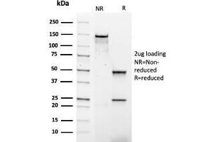 SDS-PAGE Analysis Purified IgG4 Mouse Recombinant Monoclonal Antibody (rIGHG4/1345). (Rekombinanter IGHG4 Antikörper)