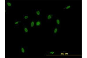 Immunofluorescence of monoclonal antibody to CSE1L on HeLa cell. (Exportin 2 Antikörper  (AA 872-971))