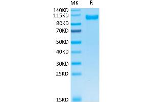 Human DPPIV on Tris-Bis PAGE under reduced condition. (DPP4 Protein (His tag))