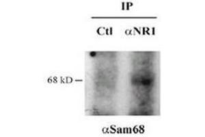 Immunoprecipitation with anti NR1 or control Western blot anti Sam68