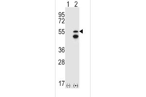 Western blot analysis of FRK (arrow) using rabbit polyclonal FRK Antibody (V28) (ABIN392097 and ABIN2841849). (FRK Antikörper  (N-Term))