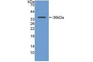 Detection of Recombinant CDH17, Human using Polyclonal Antibody to Cadherin 17 (CDH17) (LI Cadherin Antikörper  (AA 67-351))