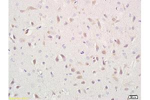 Formalin-fixed and paraffin embedded rat brain labeled with Anti- CD171/NCAM-L1 Polyclonal Antibody, Unconjugated (ABIN676463) at 1:400 followed by conjugation to the secondary antibody and DAB staining (L1CAM Antikörper  (AA 1101-1257))