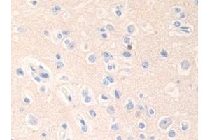 Detection of EPN1 in Human Cerebrum Tissue using Polyclonal Antibody to Epsin 1 (EPN1) (Epsin 1 Antikörper  (AA 279-437))