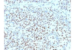 Immunohistochemistry (IHC) image for anti-Cyclin-Dependent Kinase Inhibitor 1B (p27, Kip1) (CDKN1B) antibody (ABIN7504170)