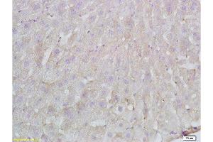 Formalin-fixed and paraffin embedded Rat liver labeled with Anti-FBN1/fibrillin 1 Polyclonal Antibody, Unconjugated  at 1:200 followed by conjugation to the secondary antibody and DAB staining. (Fibrillin 1 Antikörper  (AA 401-500))