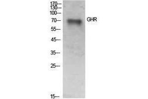 Western Blotting (WB) image for anti-Growth Hormone Receptor (GHR) (Internal Region) antibody (ABIN3178919) (Growth Hormone Receptor Antikörper  (Internal Region))