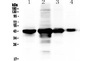 Western blot analysis of PON1 using anti-PON1 antibody . (PON1 Antikörper  (AA 30-274))