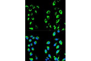 Immunofluorescence analysis of HeLa cells using NFKBIA antibody (ABIN5998339).
