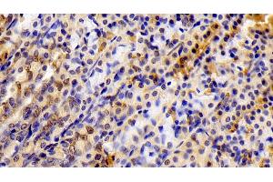 Detection of STAT6 in Rat Stomach Tissue using Polyclonal Antibody to Signal Transducer And Activator Of Transcription 6 (STAT6) (STAT6 Antikörper  (AA 557-841))