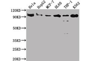 Western Blot Positive WB detected in: Hela whole cell lysate, HepG2 whole cell lysate, MCF-7 whole cell lysate, HL60 whole cell lysate, THP-1 whole cell lysate, K562 whole cell lysate All lanes: SUZ12 antibody at 1:2000 Secondary Goat polyclonal to rabbit IgG at 1/50000 dilution Predicted band size: 84 kDa Observed band size: 90 kDa (Rekombinanter SUZ12 Antikörper)