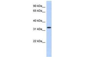 Image no. 1 for anti-metallophosphoesterase Domain Containing 2 (MPPED2) (AA 35-84) antibody (ABIN6743083) (MPPED2 Antikörper  (AA 35-84))