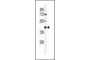 Western blot analysis of C Antibody (C-term) (ABIN653956 and ABIN2843176) in MCF-7 cell line lysates (35 μg/lane). (C9ORF91 Antikörper  (C-Term))