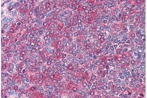 Spleen: Formalin-Fixed, Paraffin-Embedded (FFPE) (FZD7 Antikörper  (AA 559-572))