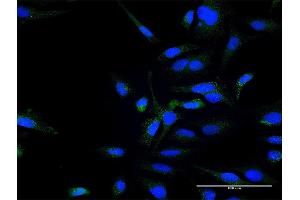 Immunofluorescence of purified MaxPab antibody to ZFYVE16 on HeLa cell. (ZFYVE16 Antikörper  (AA 1-809))