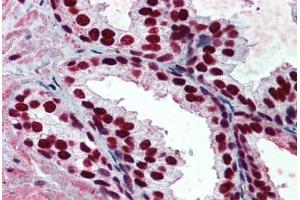 Immunohistochemistry (Formalin-fixed Paraffin-embedded Sections) (IHC (fp)) image for anti-Acidic (Leucine-Rich) Nuclear phosphoprotein 32 Family, Member A (ANP32A) (AA 1-250) antibody (ABIN790612)