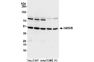 Western Blotting (WB) image for anti-Hydroxyacyl-CoA Dehydrogenase/3-Ketoacyl-CoA Thiolase/enoyl-CoA Hydratase (Trifunctional Protein), beta Subunit (HADHB) (AA 225-275) antibody (ABIN7450312)