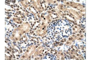 Immunohistochemistry (IHC) image for anti-Interferon-Induced Protein with Tetratricopeptide Repeats 3 (IFIT3) (N-Term) antibody (ABIN2782443) (IFIT3 Antikörper  (N-Term))