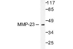 Image no. 1 for anti-Matrix Metallopeptidase 23 (MMP23) antibody (ABIN265530) (Matrix Metallopeptidase 23 (MMP23) Antikörper)