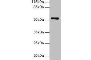 Western blot All lanes: CCDC14 antibody at 2 μg/mL + Jurkat whole cell lysate Secondary Goat polyclonal to rabbit IgG at 1/10000 dilution Predicted band size: 107, 84, 89, 52, 102 kDa Observed band size: 52 kDa (CCDC14 Antikörper  (AA 159-440))