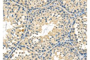 anti-Cytochrome B5 Reductase 2 (CYB5R2) (Internal Region) antibody