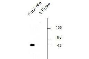 Image no. 1 for anti-cAMP Responsive Element Binding Protein 1 (CREB1) (pSer133) antibody (ABIN228620) (CREB1 Antikörper  (pSer133))