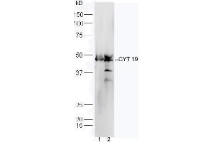Line1, mouse heart lysate; Line2, mouse liver lysate probed with Rabbit Anti-CYT19 Polyclonal Antibody, Unconjugated (ABIN2559676) at 1:300 in 4˚C. (AS3MT Antikörper  (AA 21-120))