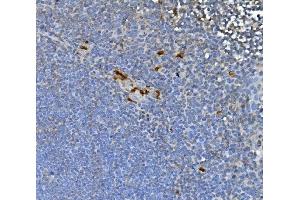 IHC analysis of JUNB using anti-JUNB antibody (ABIN7601187).