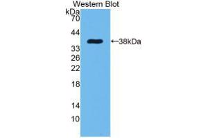 Western blot analysis of recombinant Rat EGF. (EGF Antikörper  (AA 974-1026))