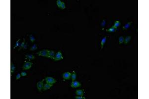Immunofluorescent analysis of HepG2 cells using ABIN7147018 at dilution of 1:100 and Alexa Fluor 488-congugated AffiniPure Goat Anti-Rabbit IgG(H+L) (Cathepsin L Antikörper  (AA 114-288))