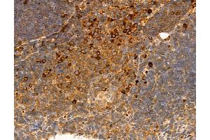 ABIN6264374 and ABIN6272975 at 1/100 staining Mouse thymus tissue by IHC-P. (PPAT Antikörper  (N-Term))
