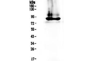 Western blot analysis of Prothrombin  using anti-Prothrombin  antibody . (Prothrombin Antikörper  (AA 67-124))