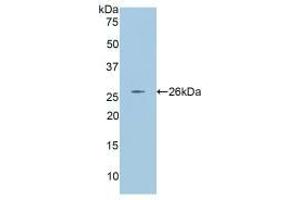 Western blot analysis of recombinant Rat ANGPT2. (Angiopoietin 2 Antikörper  (AA 33-243))