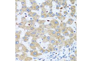 Immunohistochemistry of paraffin-embedded human liver using NMU antibody (ABIN5975084) at dilution of 1/100 (40x lens). (Neuromedin U Antikörper)