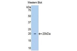 Western Blotting (WB) image for anti-Ribophorin 1 (RPN1) (AA 24-179) antibody (ABIN1175818) (RPN1 Antikörper  (AA 24-179))