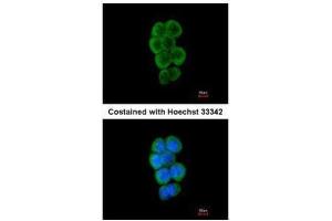 ICC/IF Image Immunofluorescence analysis of methanol-fixed A431, using CBL, antibody at 1:50 dilution.
