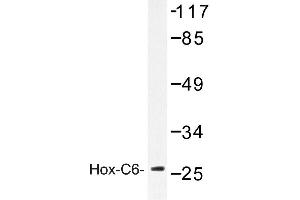 Image no. 1 for anti-Homeobox C6 (HOXC6) antibody (ABIN272159) (Homeobox C6 Antikörper)